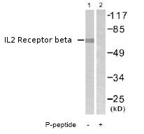 All lanes : Anti-IL2 Receptor beta (phospho Y364) antibody (ab61098) at 1/500 dilutionLane 1 : Extracts from COS7 cellsLane 2 : Extracts from COS7 cells with immunizing phosphopeptide