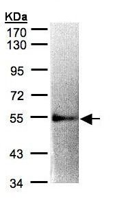 Anti-IL2 Receptor beta antibody - C-terminal (ab137699) at 1/1000 dilution + whole cell lysate prepared from Raji cells at 30 µg