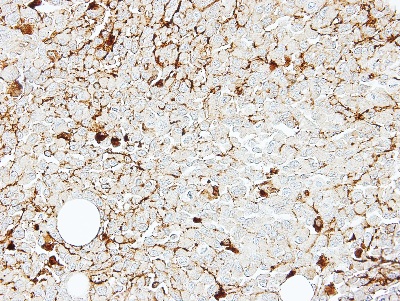 Immunohistochemical analysis of paraffin-embedded H1299 xenograft, using ab137699 at 1/100 dilution.