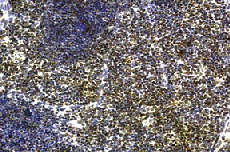 Immunohistochemistry on mouse thymus with rabbit antibody to N-terminus of mouse IL-21 receptor.