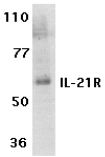 Western blot analysis of IL-21R expression in human Raji cell lysate with ab5980 at 1 µg /ml.