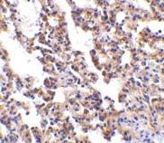 ab5980 at 10µg/ml staining IL-21R in rat lung by IHC