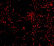 Immunofluorescence of IL-21 Receptor in Rat Lung cells using ab5980 at 20 ug/ml.