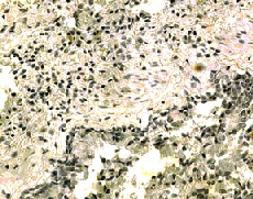 ab13321 used in IHC staining human lung at 1/300 dilution.