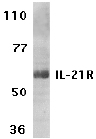 Western blot analysis of IL-21R expression in human Raji cell lysate with anti-IL-21R (NT) at 1 µg /ml