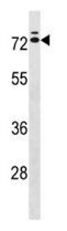 Anti-IL23 Receptor antibody (ab130661) at 1/100 dilution + K562 cell lysate at 35 µg