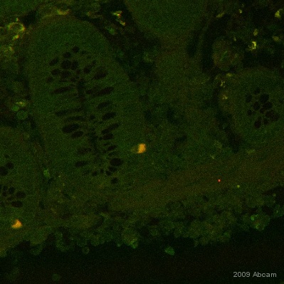 ab53656 staining IL23 in human colon by immunohistochemistry (formalin/PFA-fixed paraffin-embedded sections). Cells were formaldehyde fixed prior to blocking in 10% serum for 2 hours at 21°C. The primary antibody was diluted 1/200 and incubated with the sample for 2 hours at 21°C. Alexa fluor® 594 rabbit polyclonal was used as the secondary.See Abreview