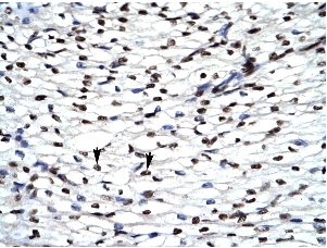 ab28507, at 4.0-8.0ug/ml, staining human HIPK2 in (Human heart, cells with positive label are Myocardial cells) by Immunohistochemistry, Paraffin embedded tissue. 