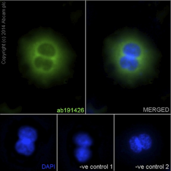 Immunofluorescent analysis of RAW 264.7cells (4% Paraformaldehyde-fixed; 0.1% tritonX-100 permeabilized) labeling IL28 + IL29 with ab191426 at 1/100 dilution followed by Goat anti rabbit IgG (AlexaFluor® 488) secondary at 1/200 dilution (ab150077) and counter-stained with DAPI (blue).Negative controls: anti-IL-28A at 1/100 dilution, followed by Goat anti mouse IgG Alexa Fluor®594 secondary at 1/400 dilution.