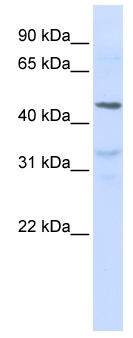 Anti-IL28 Receptor alpha antibody (ab83865) at 1 µg/ml (5% skim milk / PBS) + Jurkat cell lysate at 10 µgSecondaryHRP conjugated anti-Rabbit IgG at 1/50000 dilution