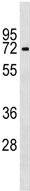 Anti-IL28 Receptor alpha antibody - C-terminal (ab156378) at 1/100 dilution + NCI-H460 cell lysate at 35 µg