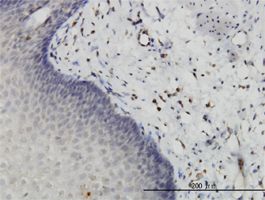 HIPK2 antibody (ab57328) used in immunohistochemistry at 1ug/ml on formalin fixed and paraffin embedded human esophagus.