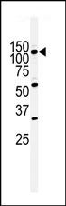 Anti-HIPK2 antibody (ab75937) at 1/200 dilution + Ramos cell line lysates at 35 µg