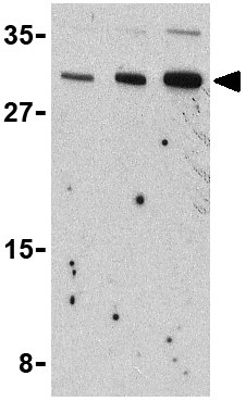 Lane 1 :  Anti-IL31 antibody (ab37157) at 2.5 µg/mlLane 2 :  Anti-IL31 antibody (ab37157) at 5 µg/mlLane 3 :  Anti-IL31 antibody (ab37157) at 10 µg/mlLane 1 : RAW264.7 cell lysateLane 2 : RAW264.7 cell lysateLane 3 : RAW264.7 cell lysateLysates/proteins at 15 µg per lane.