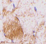 ab37157 at 10µg/ml staining IL-31 in rat skeletal muscle tissue by IHC