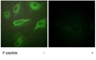 ICC/IF image of ab61099 (at a 1/500 dilution) stained HeLa cells, minus immunising peptide (left image) and plus immunising peptide (right image).