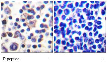 ab61101, at a 1/50 dilution, staining human IL9R (phospho S519) in lymph node, using Immunohistochemistry, Formalin/PFA fixed Paraffin embedded tissue, minus immunising peptide (left image) and plus immunising peptide (right image).