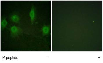 Immunofluorescent staining of HuvEc cells, using IL9R (phospho S519) antibody ab61101, minus immunising peptide (left image) and plus immunising peptide (right image).