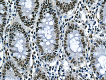 Immunohistochemical analysis of paraffin-embedded Human colon tissue labeling ILF2 with ab154169 at 1/100 dilution.