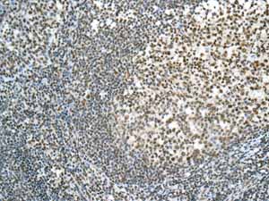 Immunohistochemical analysis of paraffin embedded Human normal tonsil tissue using ab154169 showing +ve staining.