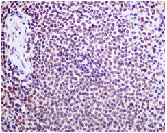 Immunohistochemical analysis of paraffin-embedded Human spleen tissue labeling ILF2 with ab154791 at 1/50 dilution.