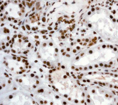 ab92355 at 1/100 dilution staining ILF3 in paraffin-embedded Human kidney tissue, by immunohistochemistry.