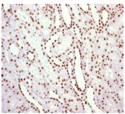 Immunohistochemical analysis of paraffin-embedded Human kidney tissue labelling ILF3 with ab133354 1/250 dilution.
