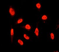 Immunofluorescent analysis of A431 cells labelling ILF3 with ab133354 1/100 dilution.