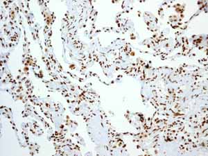 Immunohistochemical analysis of paraffin embedded normal Human lung tissue using ab133354 showing +ve staining.