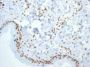 Immunohistochemical analysis of paraffin embedded normal Human skin tissue using ab133354 showing +ve staining.
