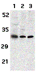 Western blot analysis of ILP-2 expression in human HepG2 (lane 1) and MOLT4 (lane 2) cell lysates and mouse spleen (lane 3) tissue lysates with anti-ILP-2 at 1 µg/ml. 
