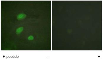 Immunofluorescence analysis of HeLa cells, using ab61095 at a 1/500 dilution, minus immunising peptide (left image) and plus immunising peptide (right image).
