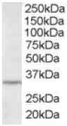 Anti-ING2 antibody (ab2643) at 2 µg/ml + HepG2 lysate (RIPA buffer, 35µg total protein per lane).