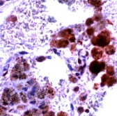 Human lung stained with ab15326 in IHC paraffin fixed sections.