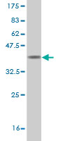 Western blot against tagged recombinant protein immunogen using ab55310 INPP5A antibody at 1ug/ml.