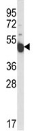 Anti-INSC antibody (ab102953) at 1/100 dilution + WiDr cell line lysate at 35 µg
