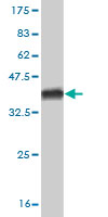 Western blot against tagged recombinant protein immunogen using ab55232 Histidase antibody at 1ug/ml.