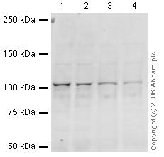 All lanes : Anti-Insulin degrading enzyme / IDE antibody (ab32216) at 1 µg/mlLane 1 : Mouse Brain at 20 µg/mlLane 2 : Brain (Rat) Whole Cell Lysate - normal tissue at 20 µgLane 3 : Mouse Hippocampus Lysate at 20 µgLane 4 : Rat Hippocampus Lysate at 20 µgSecondaryGoat polyclonal to Rabbit IgG (Alexa Fluor® 680) at 1/10000 dilutionPerformed under reducing conditions.