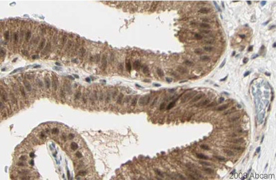 Image courtesy of Human Protein Atlasab32216 staining human Gall bladder. The paraffin embedded human skin tissue was incubated with ab32216 (1/50 dilution) for 30 mins at room temperature. The staining is predominantly cytoplasmic although some nuclear staining can be seen. Antigen retrieval was performed by heat induction in citrate buffer pH 6. Ab32216 was tested in a tissue microarray (TMA) containing a wide range of normal and cancer tissues as well as a cell microarray consisting of a range of commonly used, well characterised human cell lines.Further results for this antibody can be found at www.proteinatlas.org