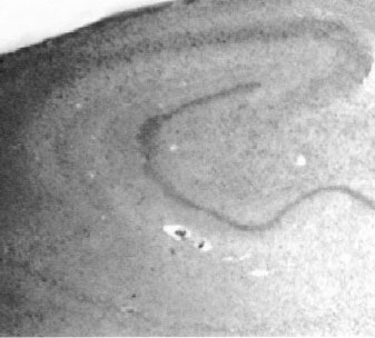 Insulin Degrading Enzyme (9B12.225) antibody immnunostaining on a paraffin embedded section of human brain. Intense IDE staining is observed with ab25733 in hippocampal dentate granular layer, hilus and CA-2/3 with lower low levels in the CA1 region.