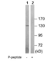 All lanes : Anti-Insulin Receptor (phospho T1375) antibody (ab79581) at 1/500 dilutionLane 1 : HepG2 cell extractsLane 2 : HepG2 cell extracts with immunizing peptide at 10 µgLysates/proteins at 10 µg per lane.