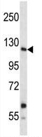 Anti-Insulin Receptor R antibody (ab123799) at 1/100 dilution + A549 cell line lysates at 35 µg