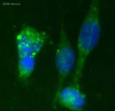 ab30483 staining human breast cancer cells by ICC/IF.  Cells were PFA fixed and blocked with 1% serum for 16 hours at 20°C prior to incubating with ab30483 (at 30µg/ml) for 16 hours at 4°C.  An Alexa Fluor® 488 conjugated goat anti-mouse antibody, diluted 1/200, was used as the secondary.See Abreview