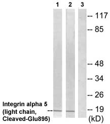 All lanes : Anti-Integrin alpha 5 antibody (ab72665) at 1/500 dilutionLane 1 : Extracts from 293 cells treated with etoposide (25uM, 1hour)Lane 2 : Extracts from A549 cells treated with etoposide (25uM, 1hour)Lane 3 : Extracts from 293 cells treated with etoposide (25uM, 1hour) with Cl-peptide at 10 µgLysates/proteins at 30 µg per lane.