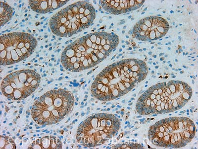 IHC image of Integrin alpha 6 staining in Human normal colon formalin fixed paraffin embedded tissue section, performed on a Leica BondTM system using the standard protocol F. The section was pre-treated using heat mediated antigen retrieval with sodium citrate buffer (pH6, epitope retrieval solution 1) for 20 mins. The section was then incubated with ab112181, 5µg/ml, for 15 mins at room temperature and detected using an HRP conjugated compact polymer system. DAB was used as the chromogen. The section was then counterstained with haematoxylin and mounted with DPX.For other IHC staining systems (automated and non-automated) customers should optimize variable parameters such as antigen retrieval conditions, primary antibody concentration and antibody incubation times.