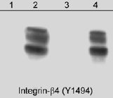 All lanes : Anti-Integrin beta 4 (phospho Y1494) antibody (ab29043)Lane 1 : A431 (25 µg/lane) serum starved overnightLane 2 : A431 (25 µg/lane) serum treated with pervanadate (1 mM) for 30 min with absence of peptideLane 3 : A431 (25 µg/lane) serum treated with pervanadate (1 mM) for 30 min with presence of phospho-integrin-beta4 (Tyr-1494) peptideLane 4 : A431 (25 µg/lane) serum treated with pervanadate (1 mM) for 30 min with presence of phospho-integrin-beta4 (Tyr-1526) peptide