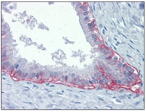 ab110167 at 20 µg/ml staining integrin beta 4 in Formalin-Fixed, Paraffin-Embedded Human Pancreas(ab29816). Sections were incubated with a biotinylated secondary antibody, followed by alkaline phosphatase-streptavidin and chromogen.