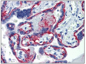 ab110167 at 20 µg/ml staining integrin beta 4 in Formalin-Fixed, Paraffin-Embedded Human Placenta. Sections were incubated with a biotinylated secondary antibody, followed by alkaline phosphatase-streptavidin and chromogen.