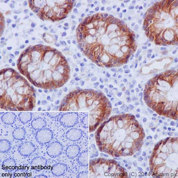 Immunohistochemical analysis of paraffin-embedded Human colon tissue labeling Integrin beta 4 with ab182120 at 1/250 dilution, followed by Goat Anti-Rabbit IgG H&L (HRP) (ab97051) secondary antibody at 1/500 dilution. Membrane and cytoplasm staining on Human colon epithelium is observed. Counter stained with Hematoxylin.Secondary antibody only control: Used PBS instead of primary antibody, secondary antibody is Goat Anti-Rabbit IgG H&L (HRP) (ab97051) at 1/500 dilution.