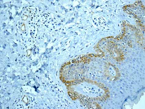 ab168386 showing +ve staining in Human skin.